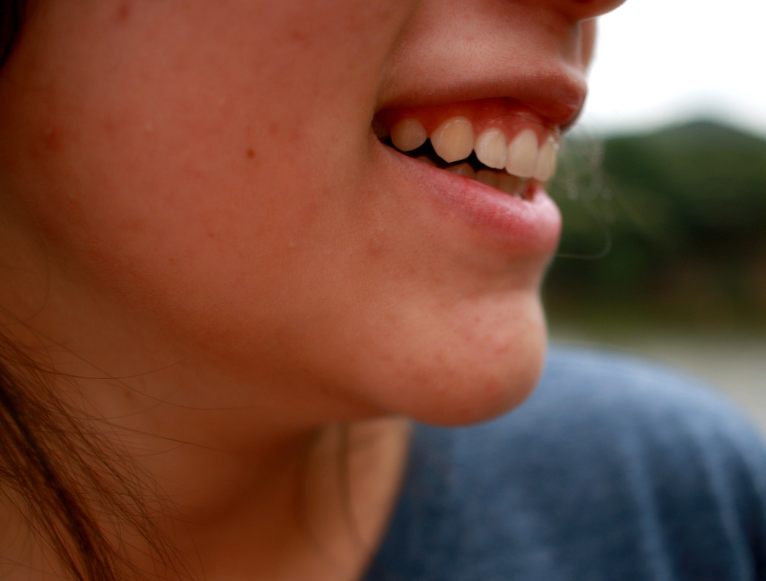 볼과 턱에 여드름