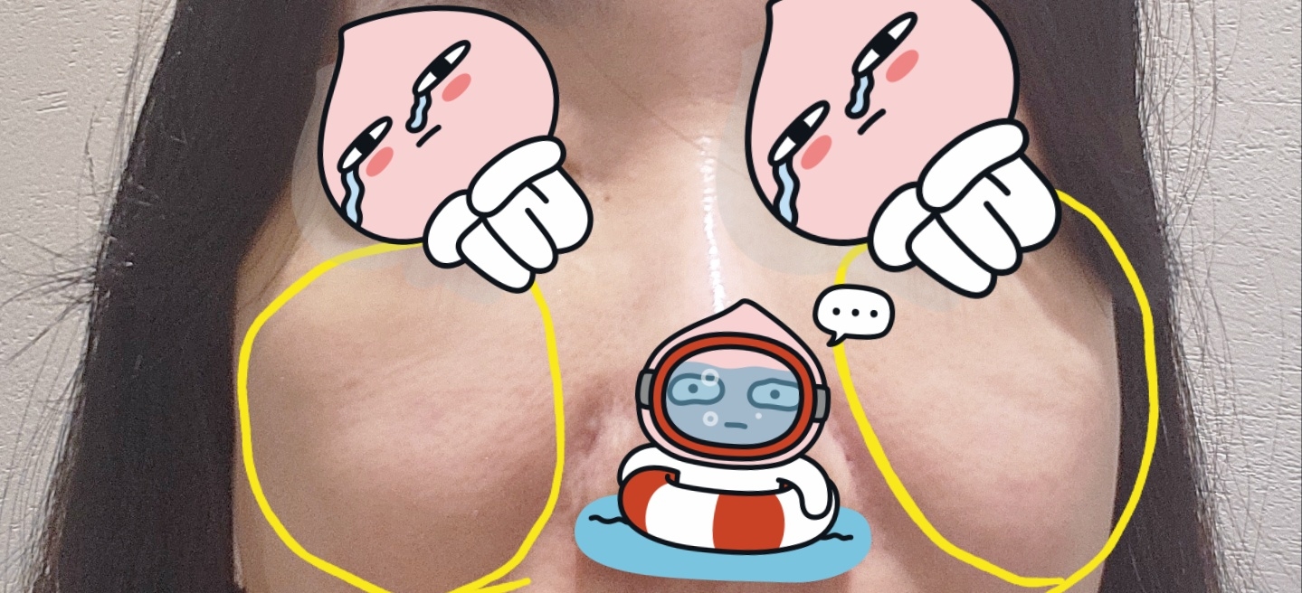 시술전 내얼굴