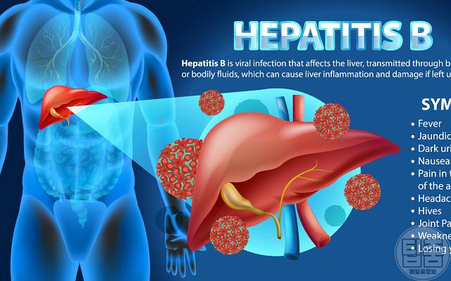간암 원인 b형간염 40대 50대 간암 예방법