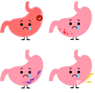 위암 초기증상, 수술비용, 수술후 회복기간 총정리 (2024ver)