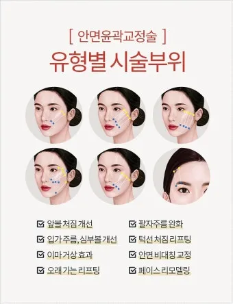 덴서티 리프팅 댄서티 가격 효과 유지기간에 관한 정보_16