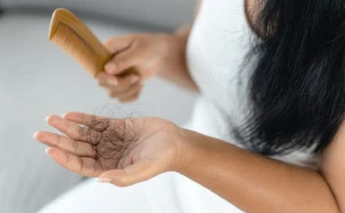 탈모의종류와원인