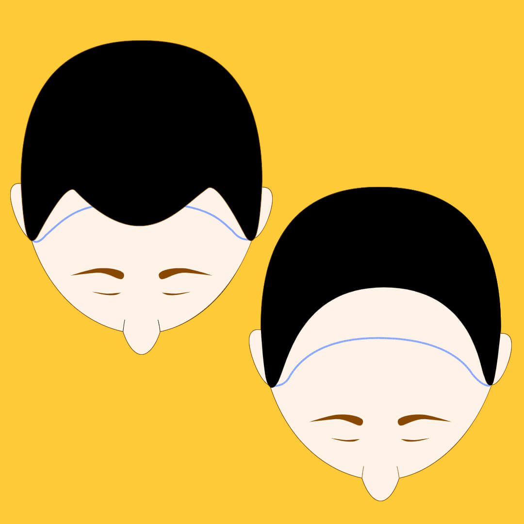 판시딜 효과 가격 복용법 및 부작용 