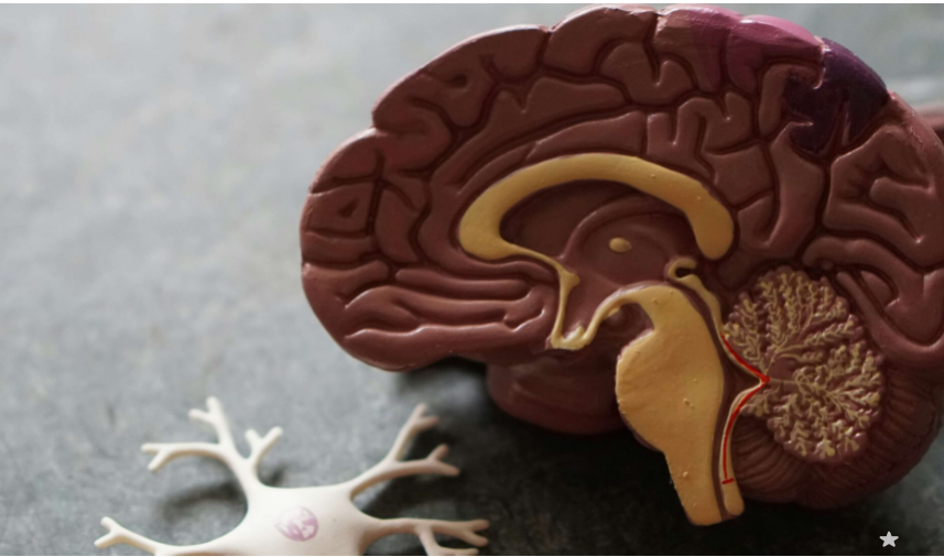  뇌경색 전조증상 확인법과 FAST 자가진단 및 골든타임 예방 관리 가이드