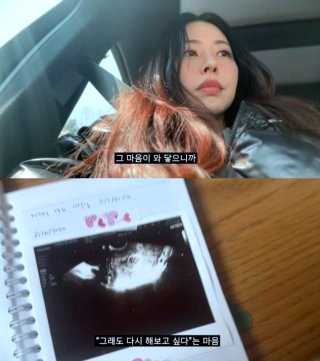 서동주 계류유산 서세원 서정희 딸 프로필