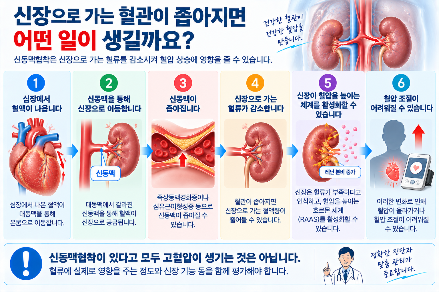대동맥에서 신동맥으로 혈액이 공급되고 협착 시 신장 혈류가 줄 수 있음을 설명한 그림