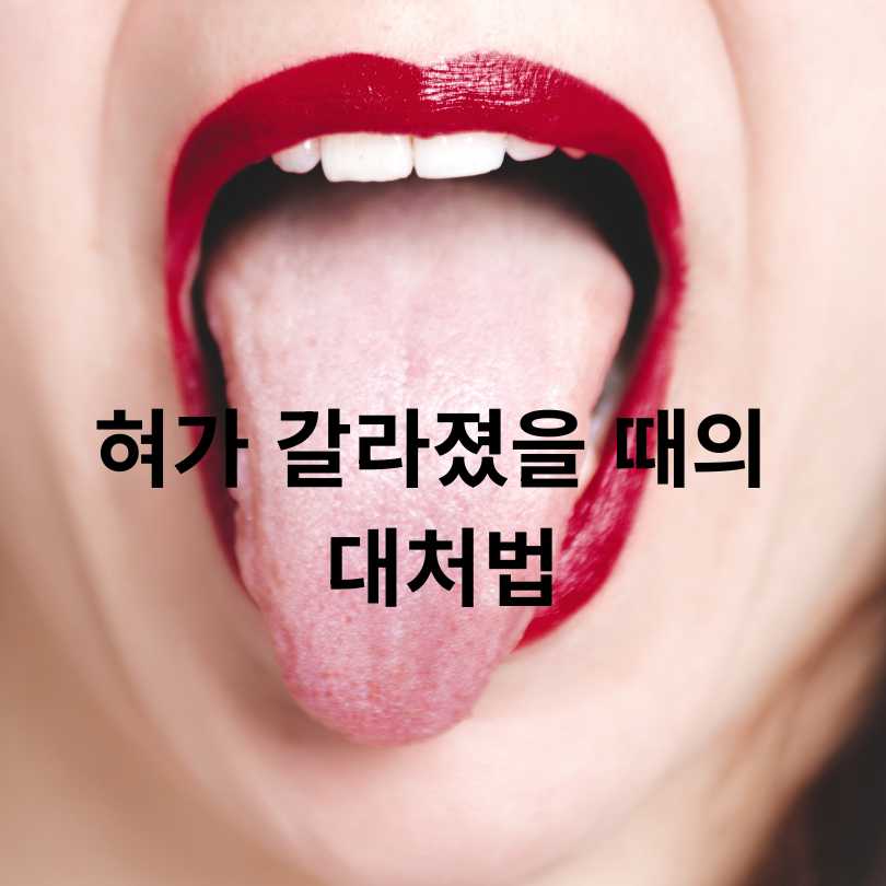 혀 갈라짐의 원인과 대처법