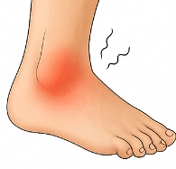 발목 접질렀을때