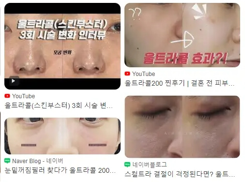 울트라콜