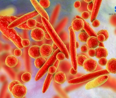 마이코플라즈마 폐렴 치료방법