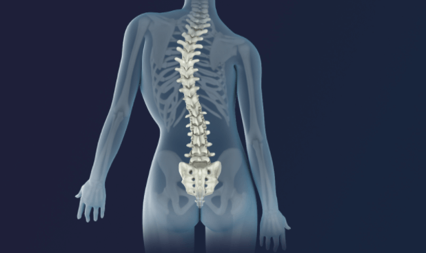 척추가 휜 그림