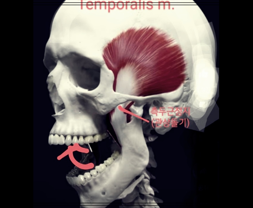 측두근과 건강: 왜 측두근이 중요한가?