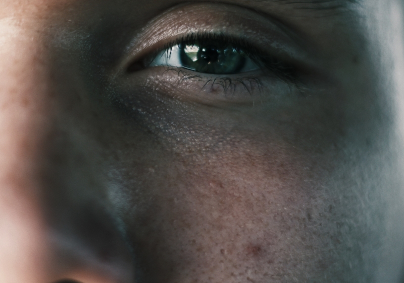 피부모공을 보여주는 사진