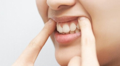 잇몸이 붓고 아플때