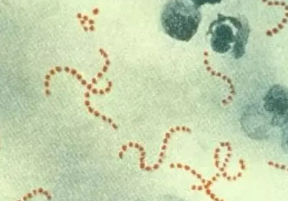 치사율 30% 감염병