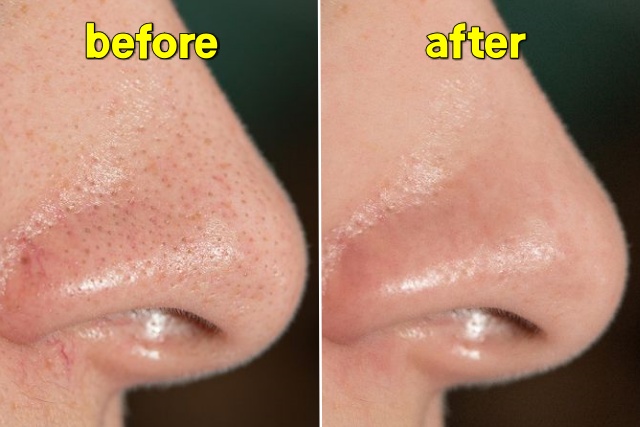 자연적으로 코 모공 줄이는 방법,모공축소 시술 없이,뷰티 팁줌 매일꿀정보