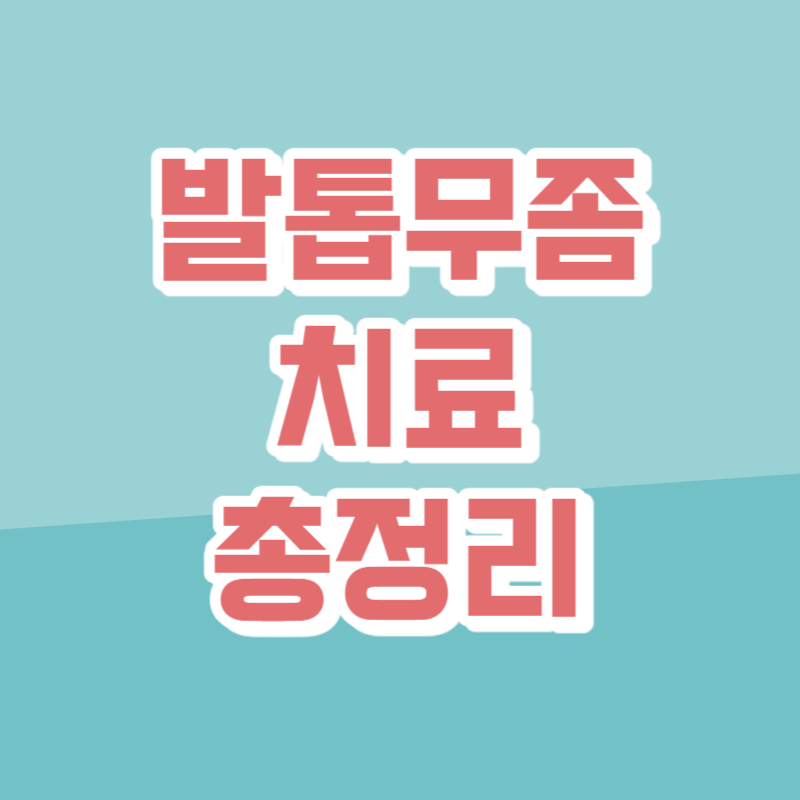 발톱무좀 치료