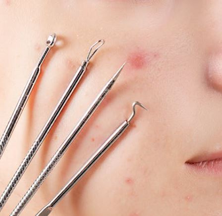 여드름 빨리 없애는 법 원인 증상