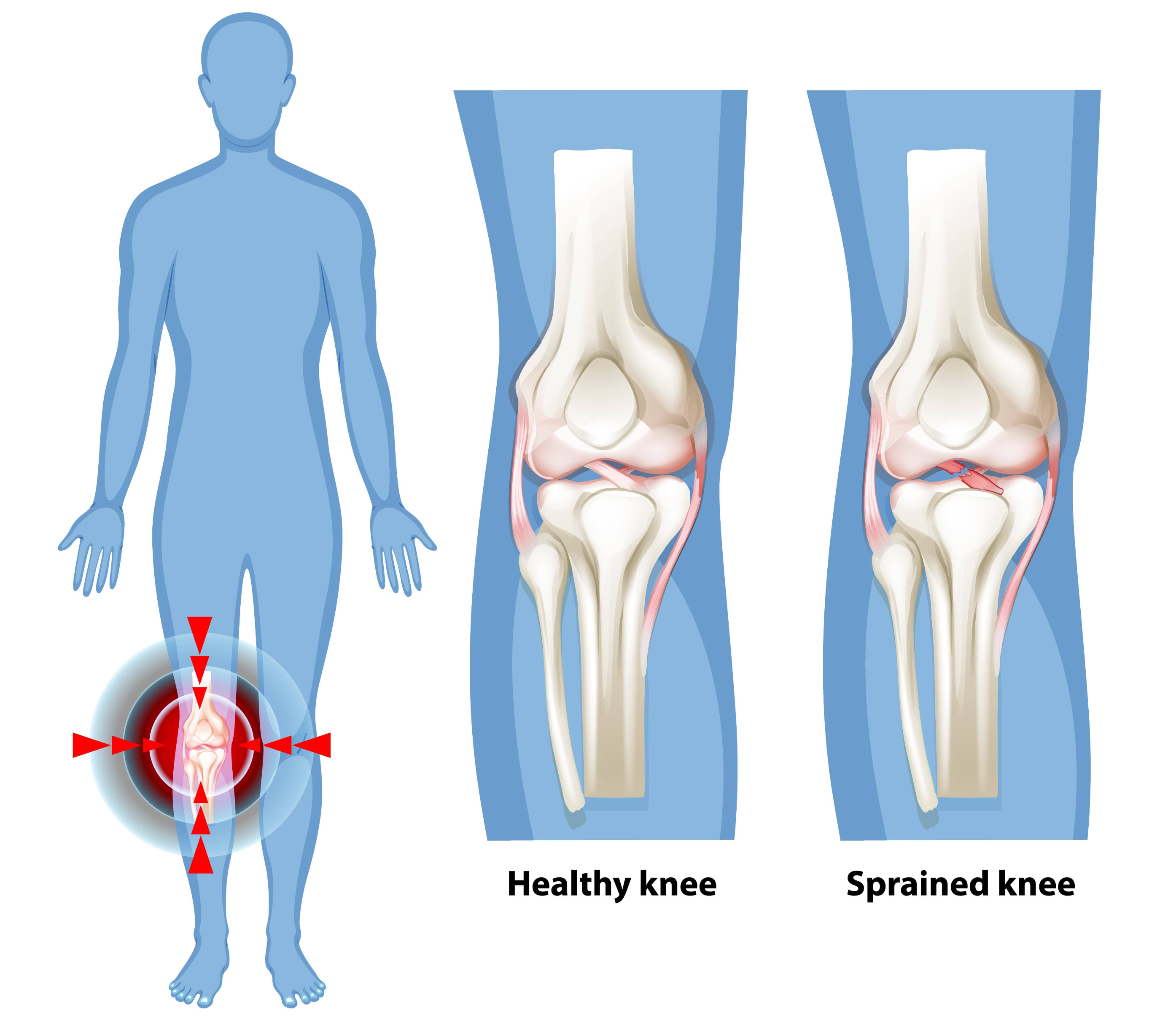무릎 안쪽 통증 원인