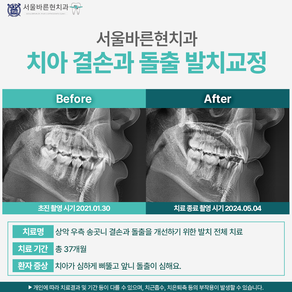 부산교정치과
