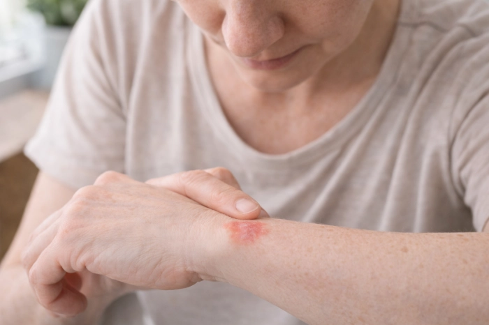 피부암 초기증상