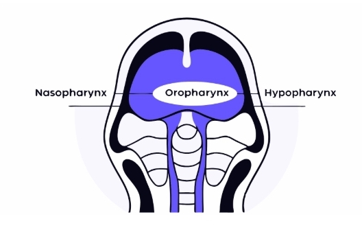 인두암 수술과정