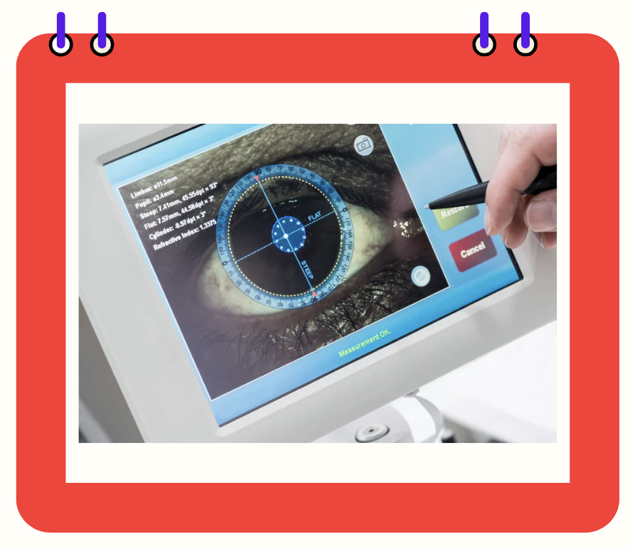 천안녹내장안과 전문병원