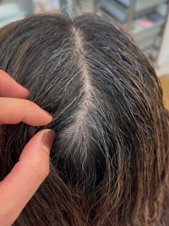 정수리-부분에-새치가-올라오는-모습