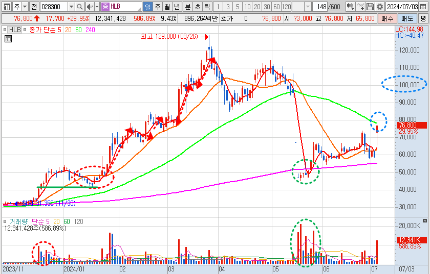 HLB 주가 일봉 차트 분석