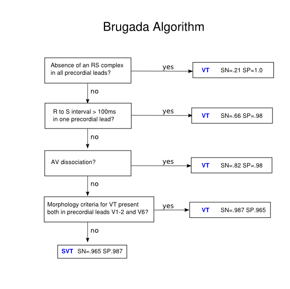 brugada's criteria