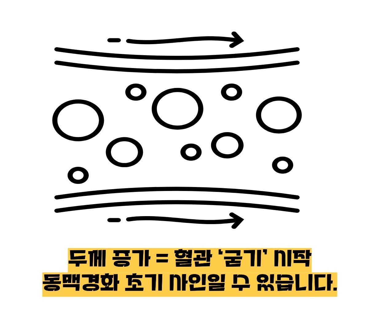 경동맥 두께 정상수치