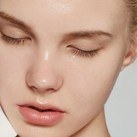 여드름 관리 방법 식습관