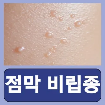 비립종 생기는 이유 비립종 없애는 방법 피부 관리법_16