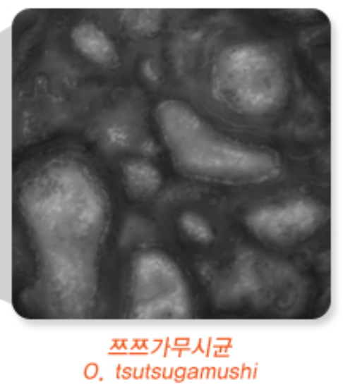쯔쯔가무시 간수치! 질병의 이해와 관리