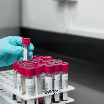 안성기 혈액암 투병