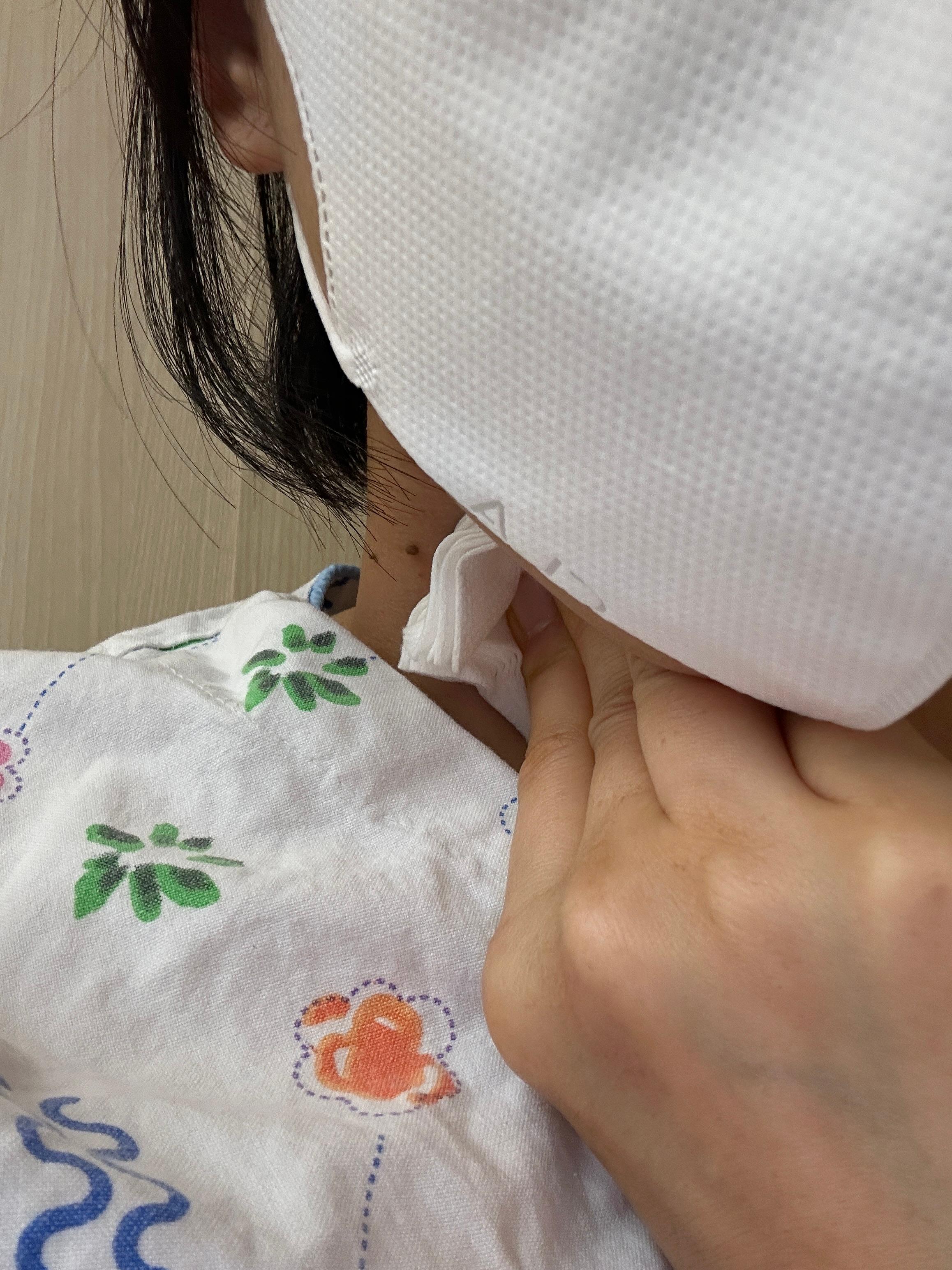 문화병원에서 갑상선 조직검사 후 지혈