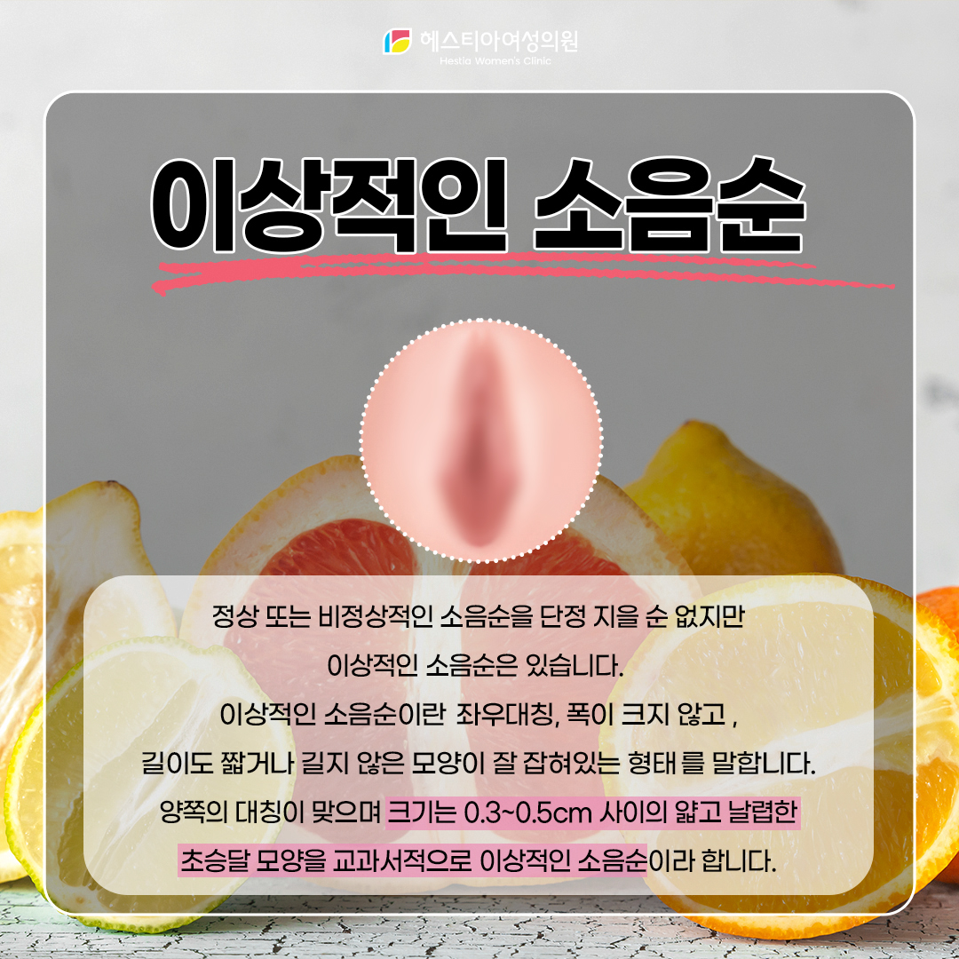 이상적인 소음순