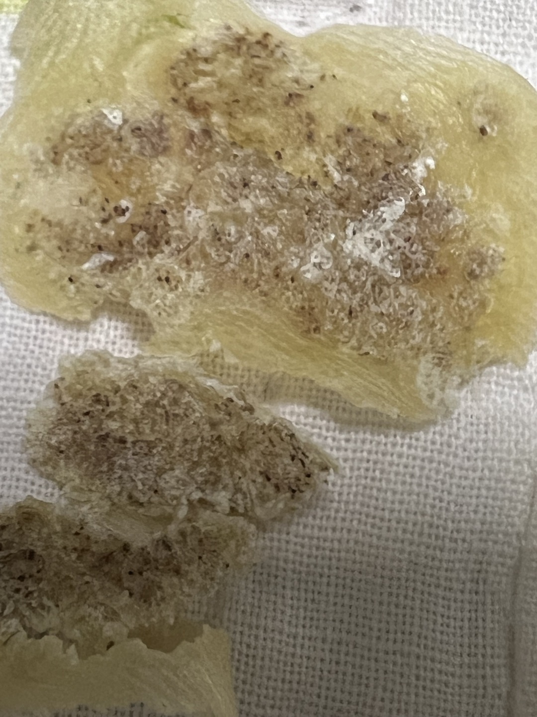 사마귀 점성출혈