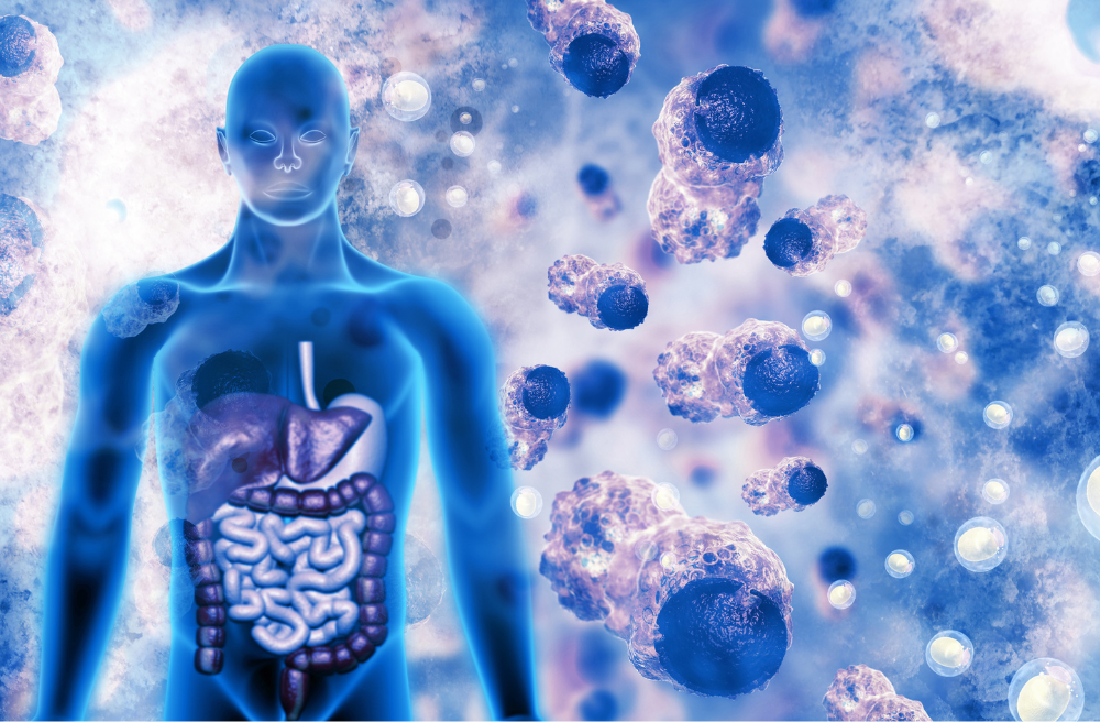 방광암 증상 원인