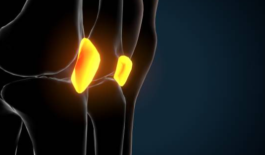 류마티스 관절염