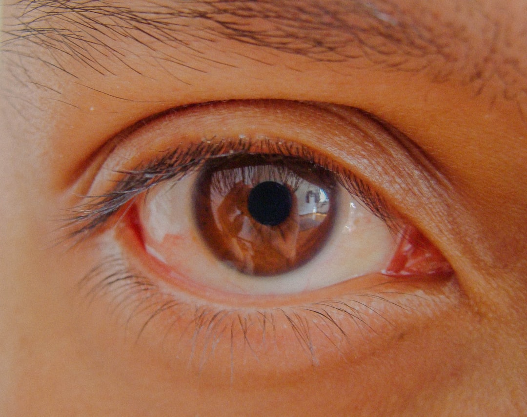 Cataract