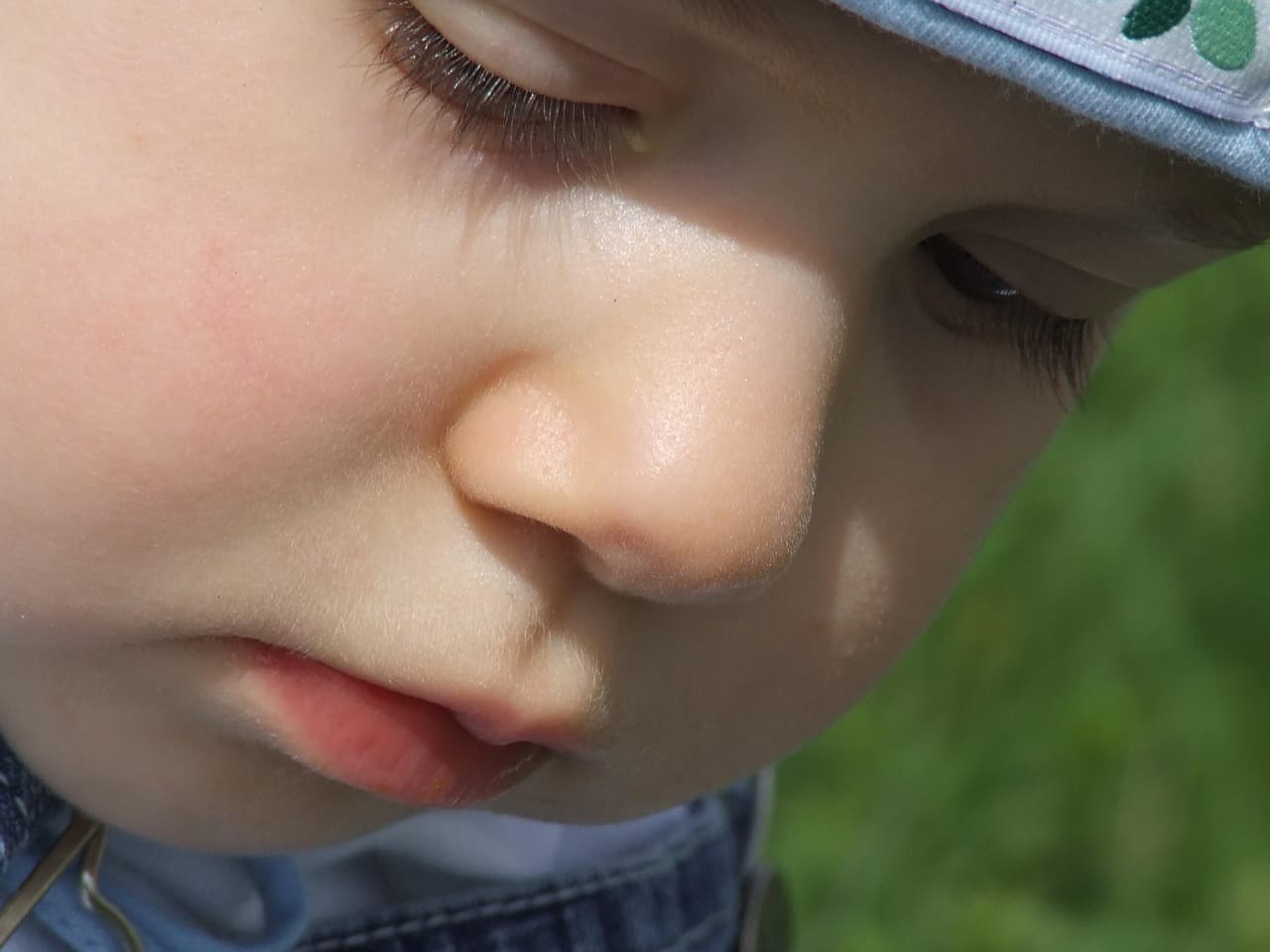 마이크로바이옴과 피부 건강, 트러블과의 관계