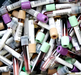 빈혈 치료방법 진단기준 합병증