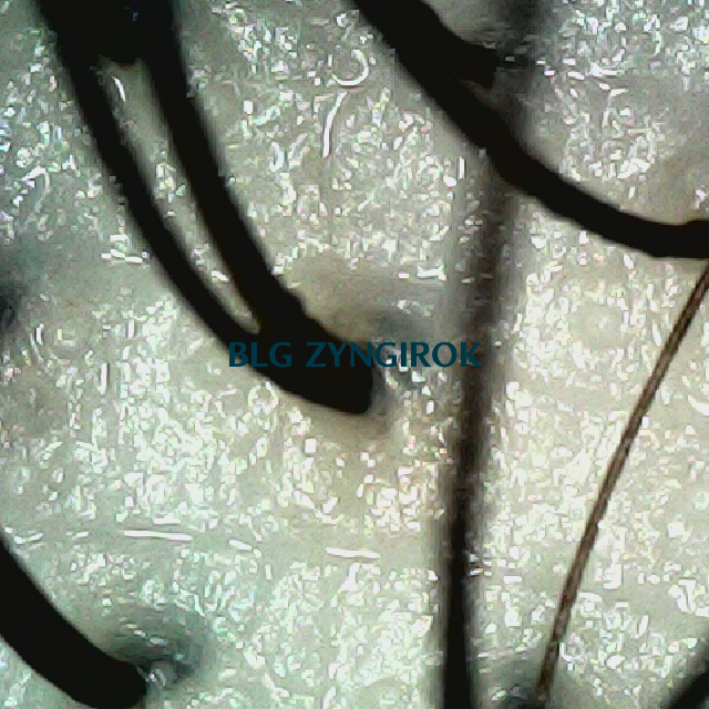 탈모 극복 프로젝트 - 뒷머리 두피 모습이다.