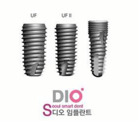 부산해운대구-임플란트-잘하는곳-추천-임플란트가격-임플란트후기 
