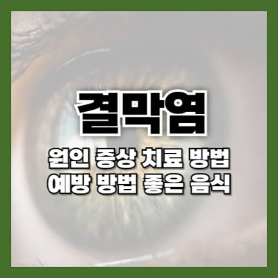 결막염 음식
결막염 증상
결막염 전염
결막염 치료
결막염 안약
결막염 원인
알레르기성 결막염
결막염 치료기간
결막염 약
결막염 전염성
결막염 유행
알레르기 결막염
유행성 결막염