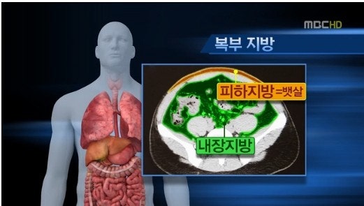 복부비만과 흡연, 허리 통증 악화 원인.. 관련 이미지