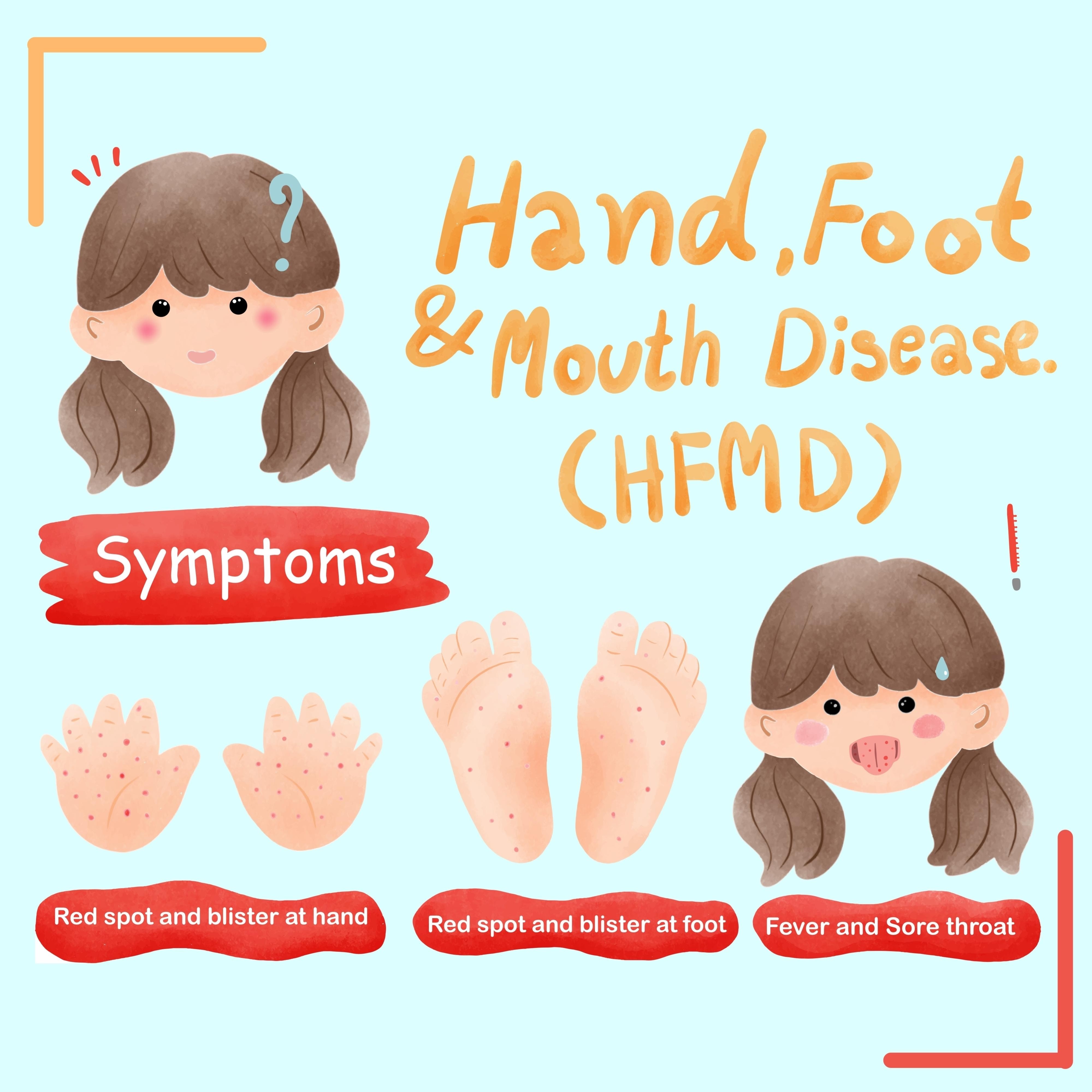 손, 발, 입에 나타나는 특징적인 수포