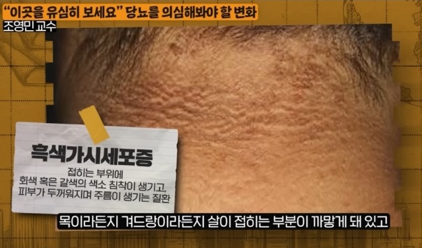 당뇨-명의-귀하신몸-조영민교수