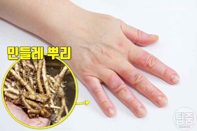 간에 좋은 차 민들레차 효능 습진 민들레차부작용